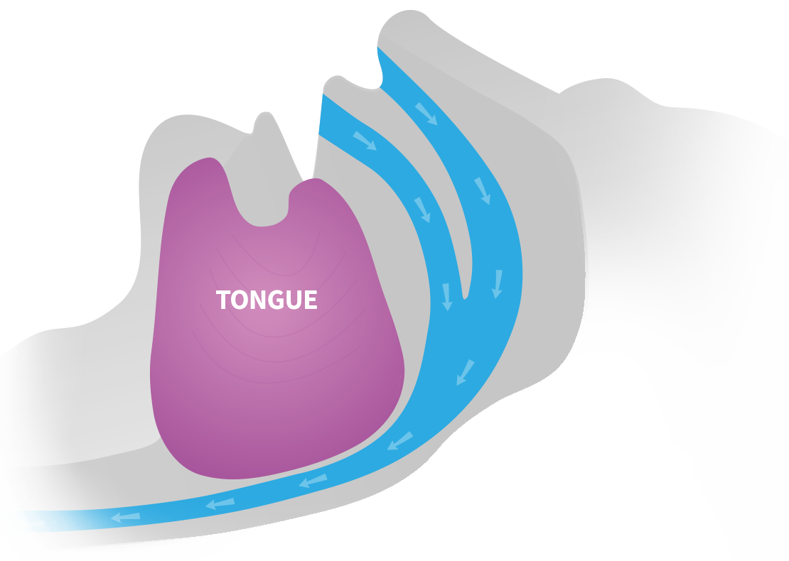 airway open due to strengthened tongue muscle